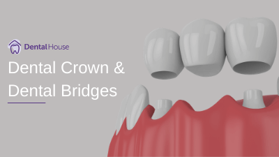Dental Crown & Dental Bridges