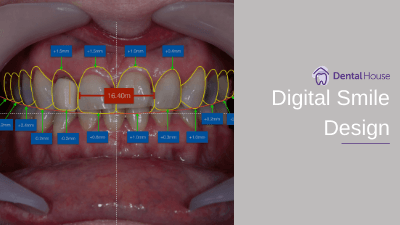 Digital Smile Design