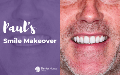 Paul’s Smile Makeover Journey in Bacchus Marsh