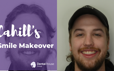 Cahill’s Smile Makeover in Sunbury