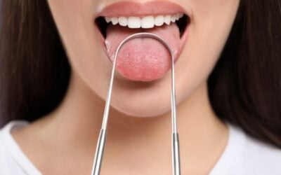 Talk Of The Tongue: Changes That Tell The State Of Your Health