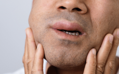 Is That Swelling a Dental Emergency? Warning Signs You Shouldn’t Ignore