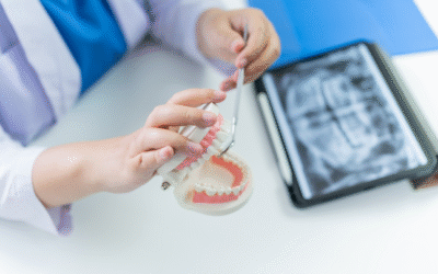 Why Your Upper Jaw Might Need Help Before Dental Implants