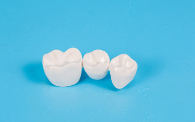 How CEREC Eliminates the Guesswork from Crown Fitting