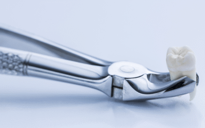 Simple vs Surgical: The Two Faces of Wisdom Tooth Removal