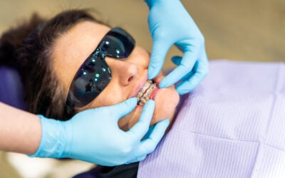 Adult Braces in Gisborne: An Honest Guide to Your Options