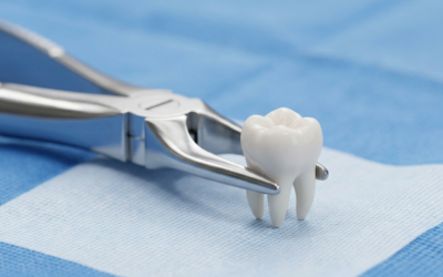 Simple vs Surgical: The Two Faces of Wisdom Tooth Removal