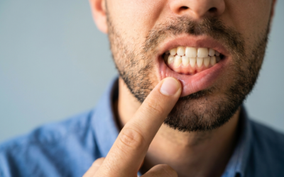 Reverse Periodontitis? Eureka! An Antibiotic