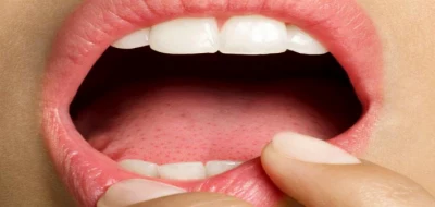 Things Your Mouth Can Tell You about Your Health