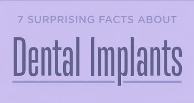 Surprising Facts About Dental Implants