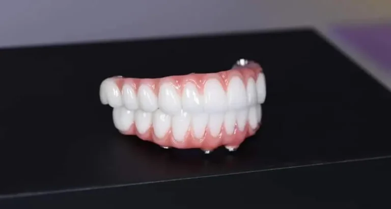 All-On-4-Plus-vs-Traditional-Dentures-A-Chewing-Efficiency-Comparison-Sunbury-Dental-House-1