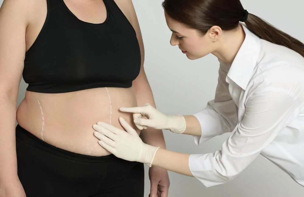 Bariatric Surgery Can Work Well But Not For Oral Health