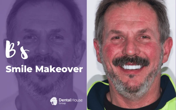Bs Smile Makeover in Bacchus Marsh