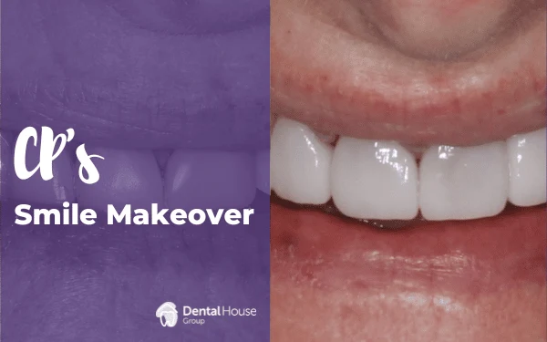 CPs Smile Makeover in Gisborne