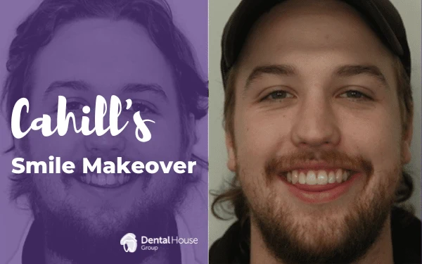 Cahills Smile Makeover in Sunbury