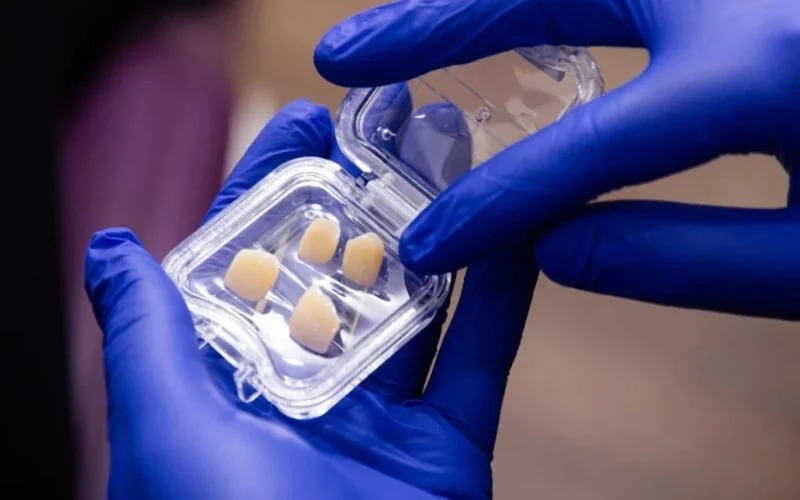 Choosing Crown Materials What Actually Goes on Your Implant