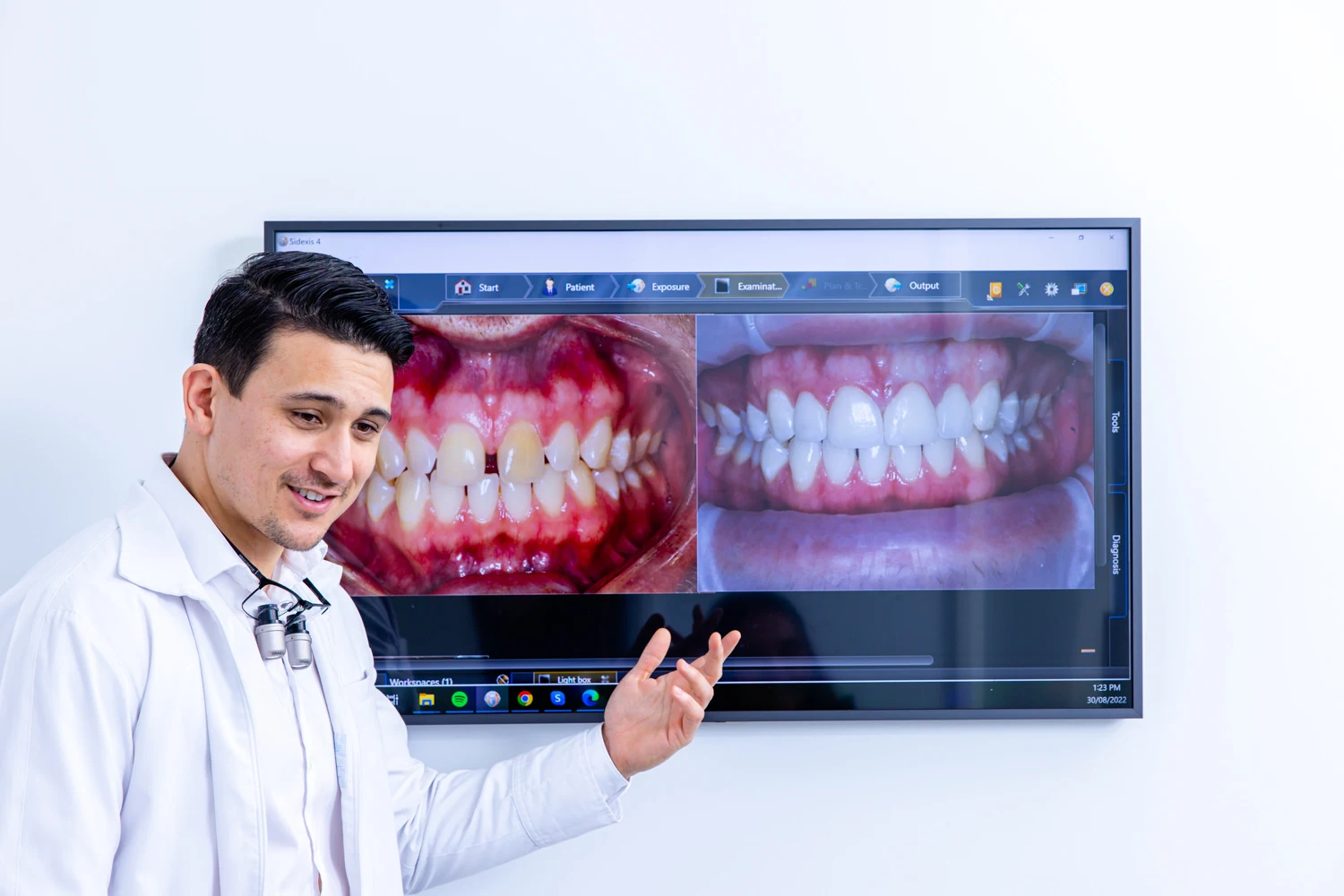 Dental Veneers Near Me What Gisborne Residents Should Know Before Getting Started