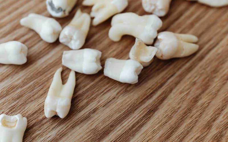 Donating Teeth to Science Do It While Alive or Dead