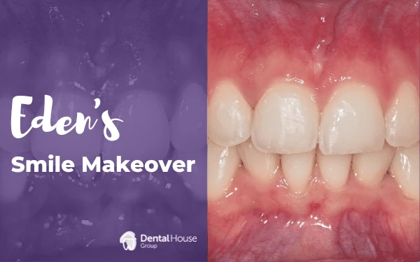 Edens Invisalign Smile Makeover in Bacchus Marsh