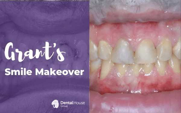 Grants Smile Makeover in Gisborne