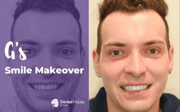 Gs Smile Makeover in Melbourne