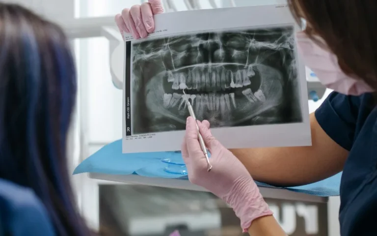 Having-A-Dental-X-Ray-Sweet-Stick-A-Fruit-Roll-Up-In-Your-Mouth-At-Sunbury-Dental-House-In-Sunbury