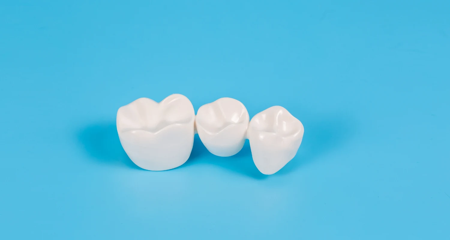 How CEREC Eliminates the Guesswork from Crown Fitting