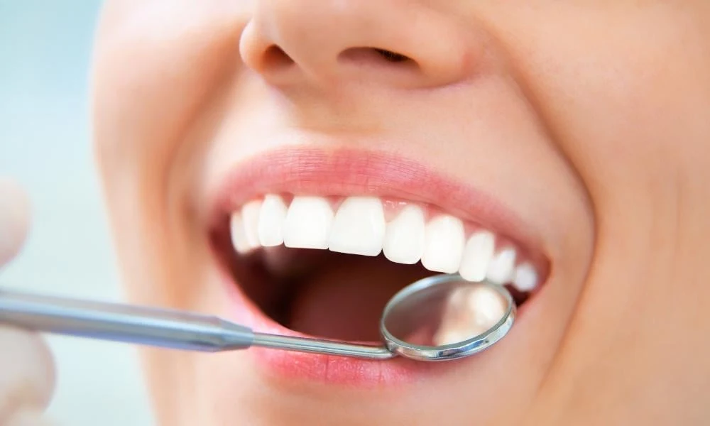 How Did Straight White Teeth Become The Beauty Ideal