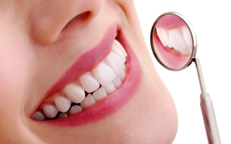 How Professional Fluoride Varnish Benefits Adult Tooth Enamel Health