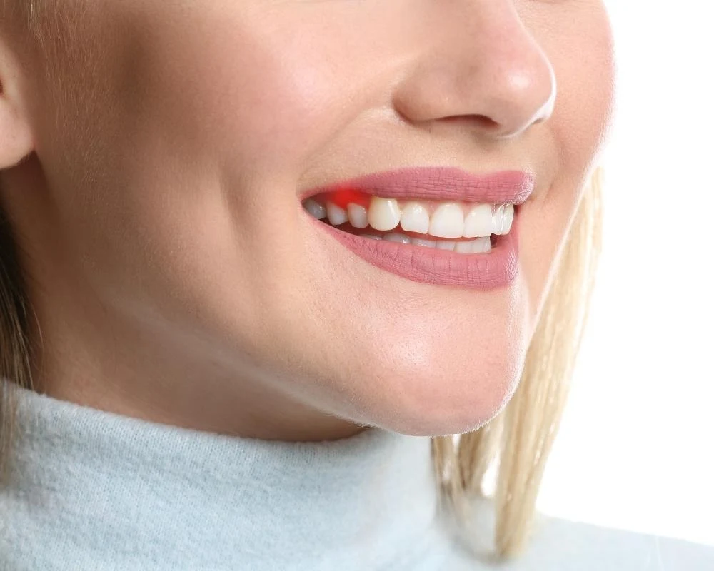 Hows Your Gingiva How To Protect Your Types of Gingiva from Gingivitis