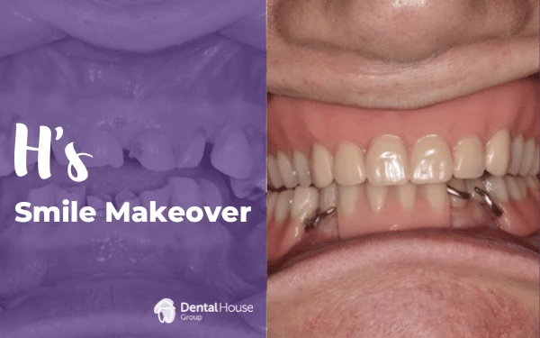 Hs Denture Journey in Melbourne