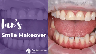 Ians Smile Makeover in Gisborne