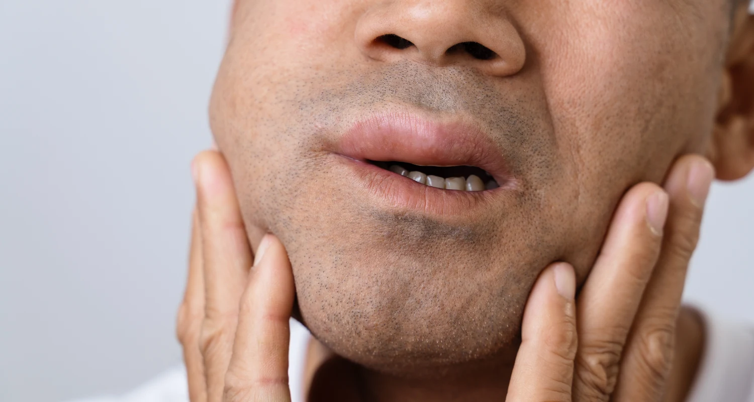 Is That Swelling a Dental Emergency Warning Signs You Shouldnt Ignore