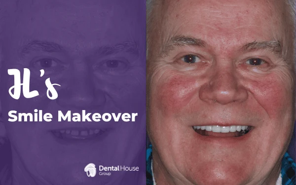 JLs Smile Makeover in Sunbury