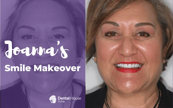 Joannas Smile Makeover in Bacchus Marsh