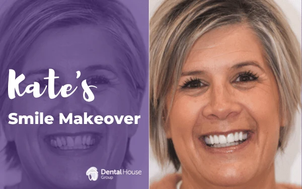 Kates Smile Makeover in Bacchus Marsh