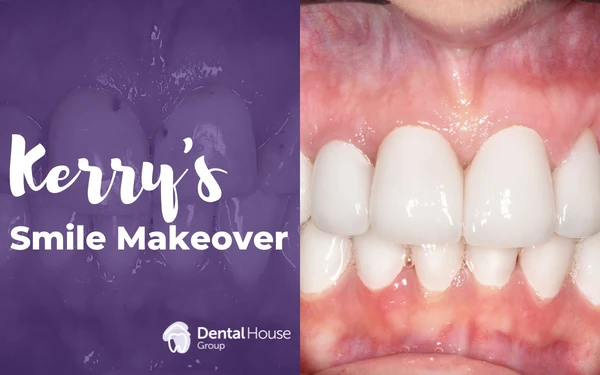 Kerrys Smile Makeover in Bacchus Marsh