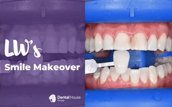 LWs Smile Makeover in Sunbury