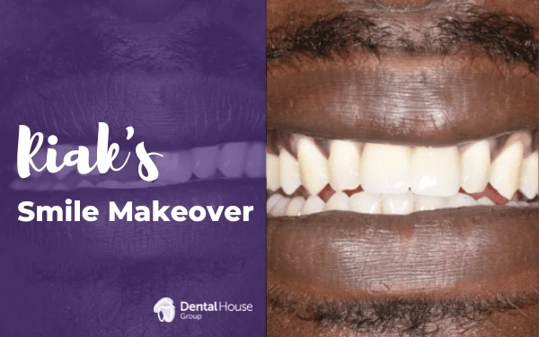 Riaks Smile Make over in Sunbury