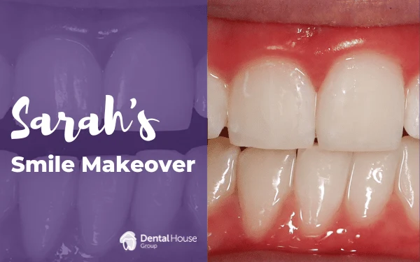 Sarahs Smile Makeover in Melbourne