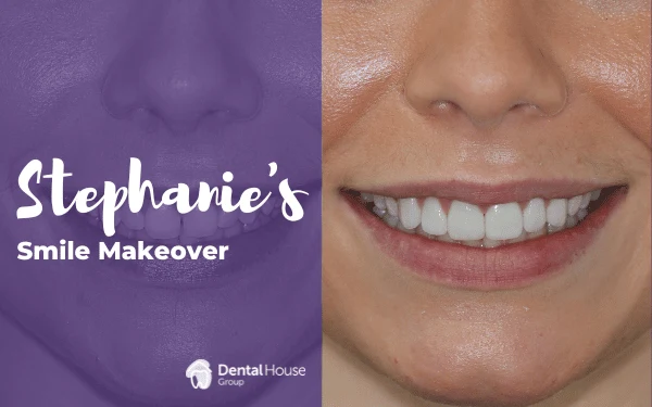 Stephanies Smile Makeover in Sunbury