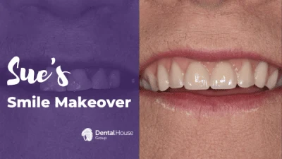 Sues Denture Journey in Melbourne