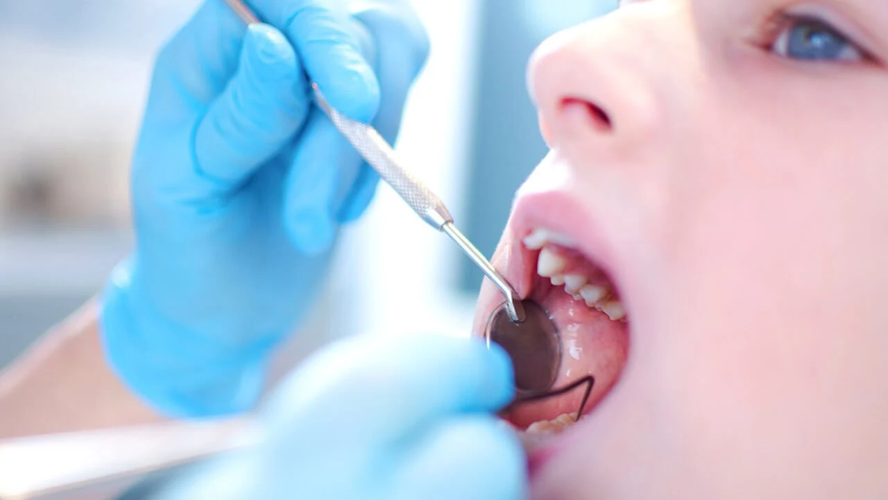 Tooth Decay Babies Children Teenagers