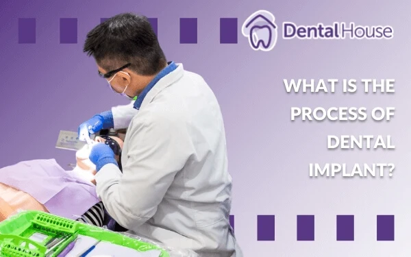 What Is The Process Of Dental Implant