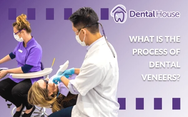 What Is The Process Of Dental Veneers