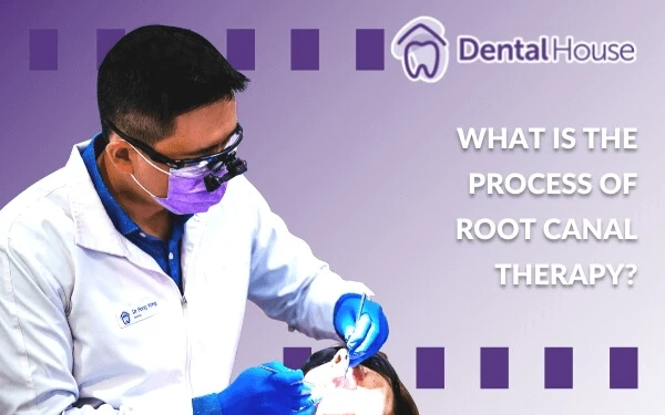 What Is the Process of Root Canal Therapy