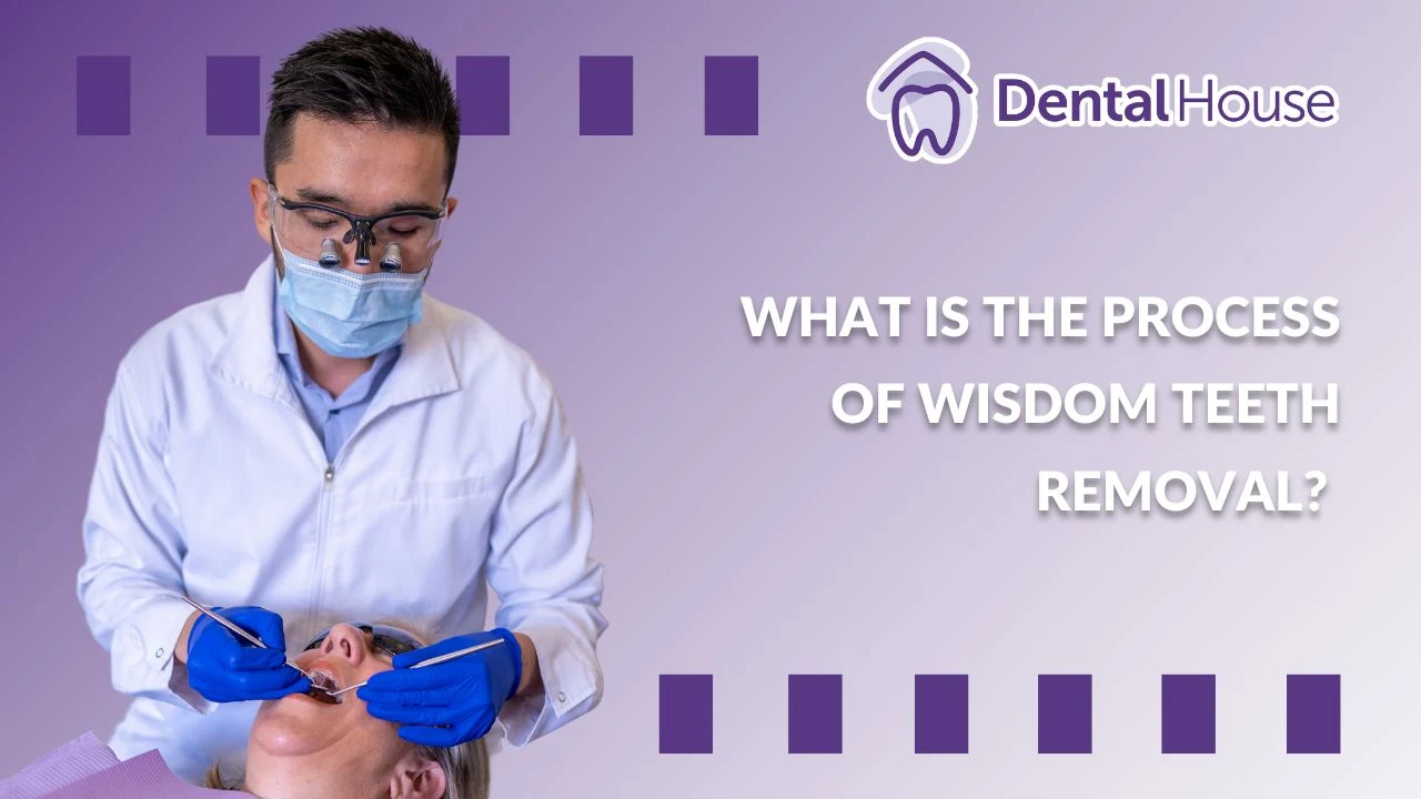 What Is the Process of Wisdom Teeth Removal