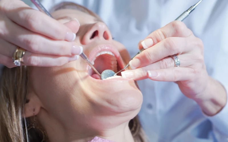 Why Dental Implants Often Outperform Traditional Bridges
