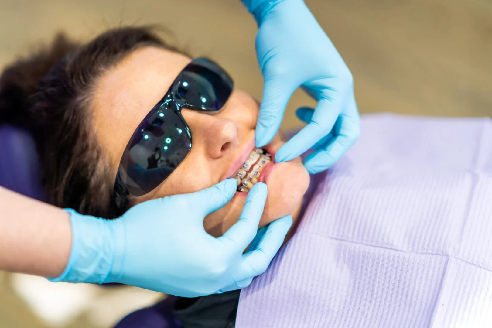 Why is extra oral care needed during orthodontic treatment